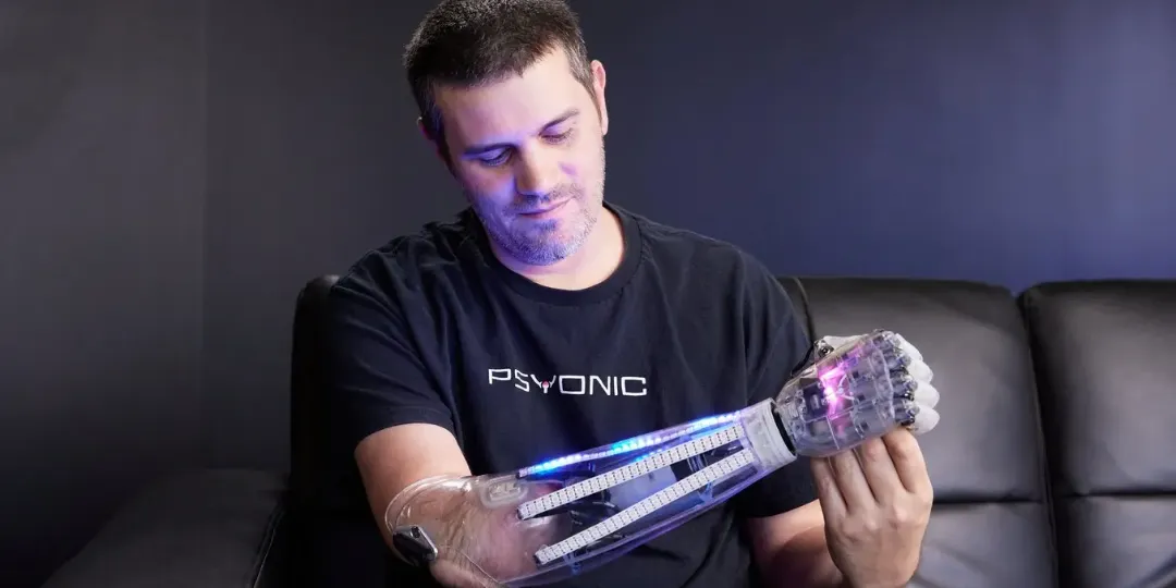PSYONIC如何利用敏捷製造打造世界上最容易使用的仿生手